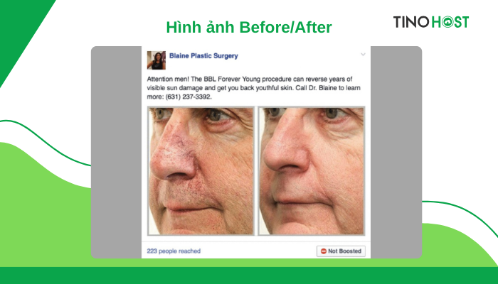 tranh-dang-hinh-anh-before-after